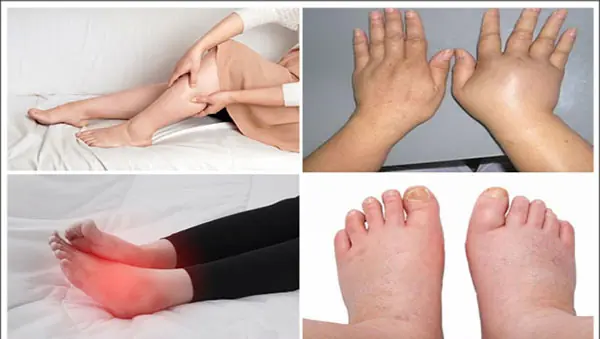 6 Simple Ways to Reduce Water Retention