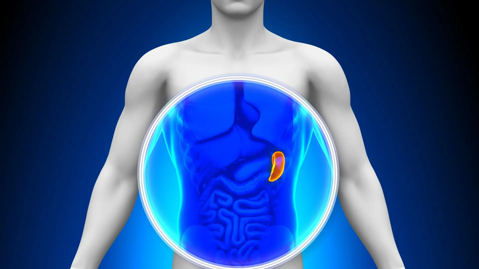 Spleen Cancer: A Rare But Dangerous Disease - You Need To Know!
