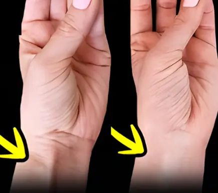 Connection Between Your Tendon and Evolution