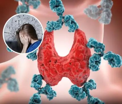 The Hidden Toll of People-Pleasing: How Emotional Suppression Can Trigger Autoimmune Disorders