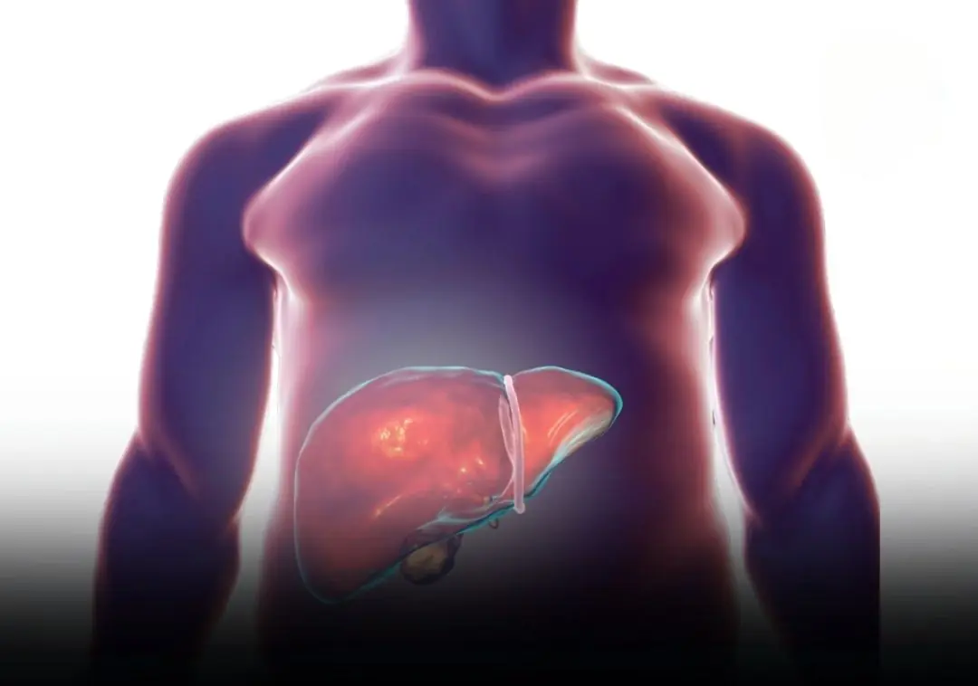 How to Know Whether a Protruding Belly Is Fat or a Sign of Liver Problems