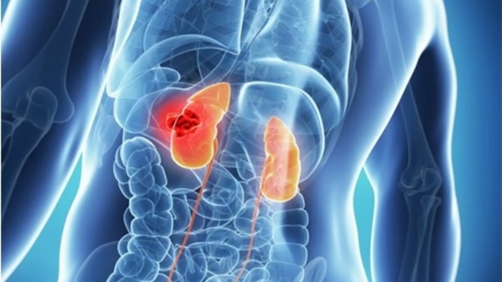 4 breakfast dishes that many people love but des.troy the kidneys very quickly