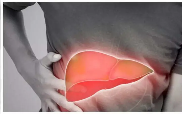 What you need to know about fat.ty liver: Causes, symptoms and remedies