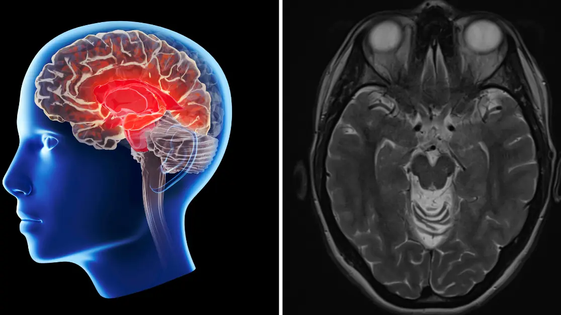 4 red flags your brain is in trouble as scientists warn Alzheimer's starts decades before you realize