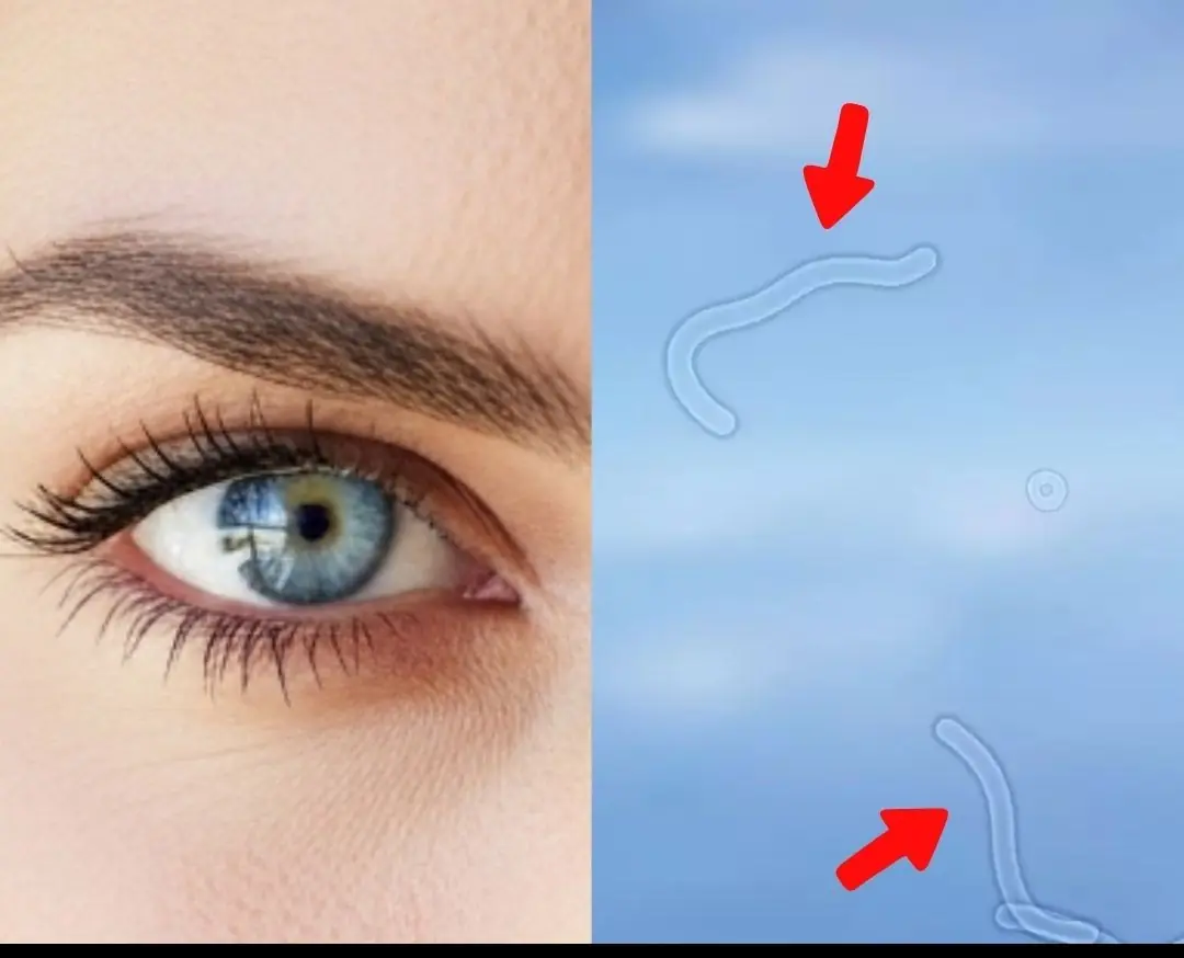 An Eye Doctor Explains What to Do If You Start Seeing “Floaters”