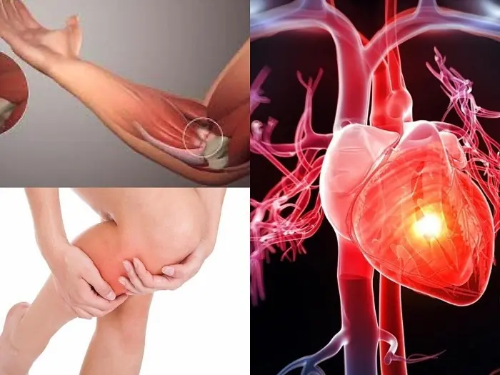 One Month Before a He.art Attack, Your Body Sends Seven Warning Signals Most People Ignore