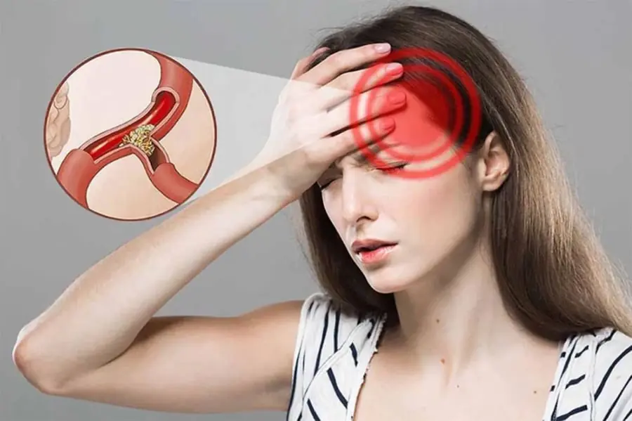 5 risks of cerebral ischemia and how to prevent them