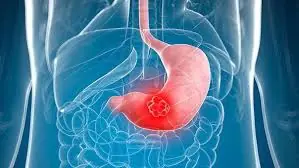 5 Symptoms After Meals That Could Indicate Stomach Cancer