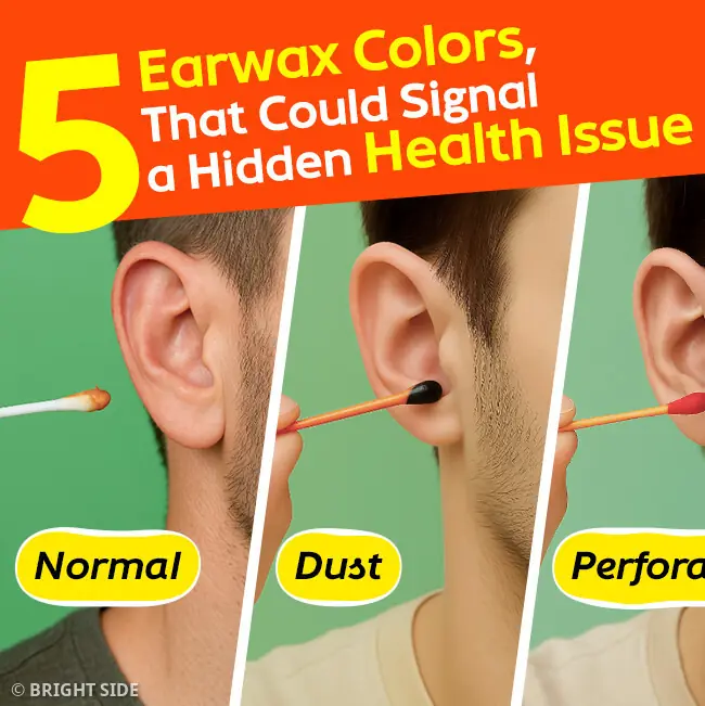 5 Earwax Colors That Could Signal a Hidden Health Issue