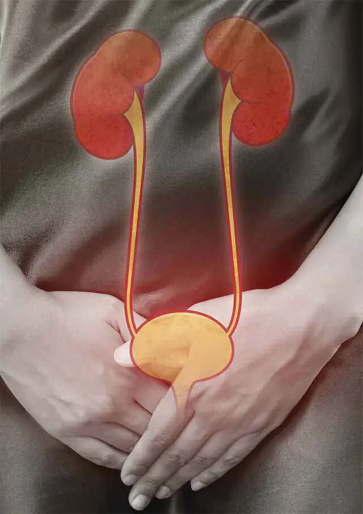 5 Common Signs of Bladder C.a.n.c.e.r That You May Ignore