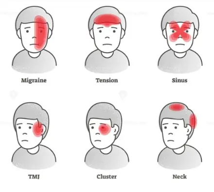 This is How Headaches Reveal What is Wrong With Your Health