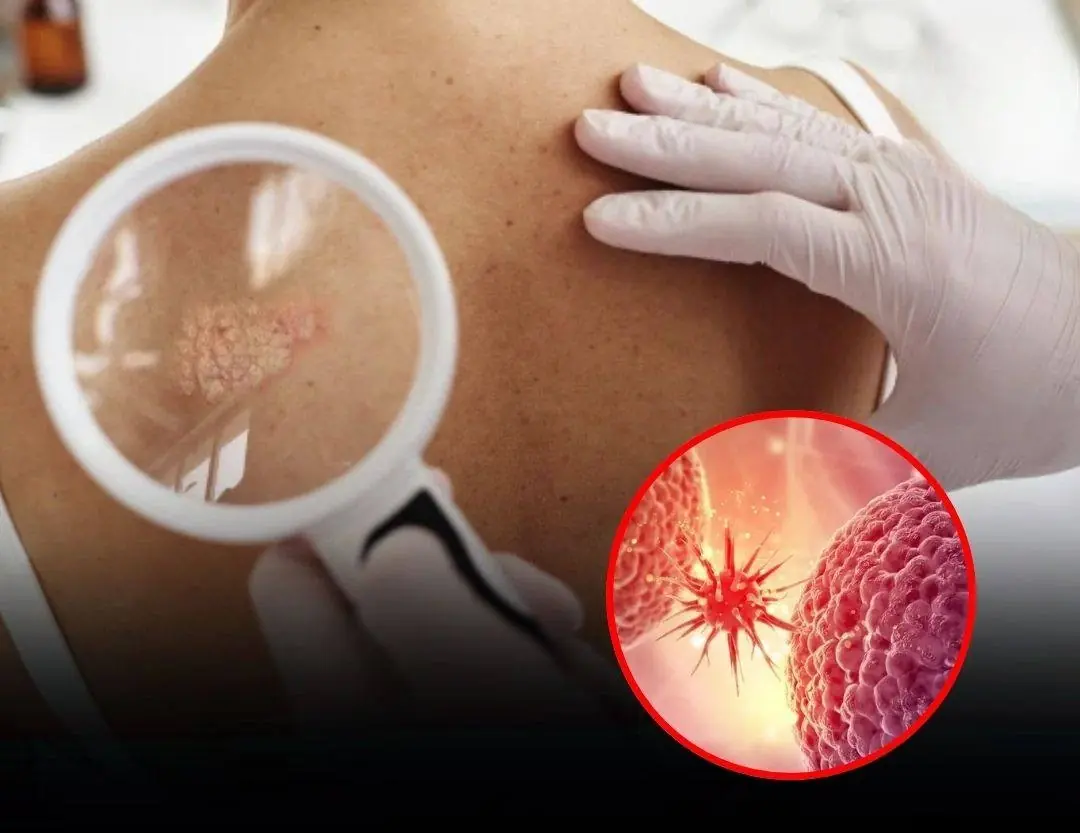 Don’t Ignore These 20 Early Warning Signs That Your Body Could Be Fighting Can:cer