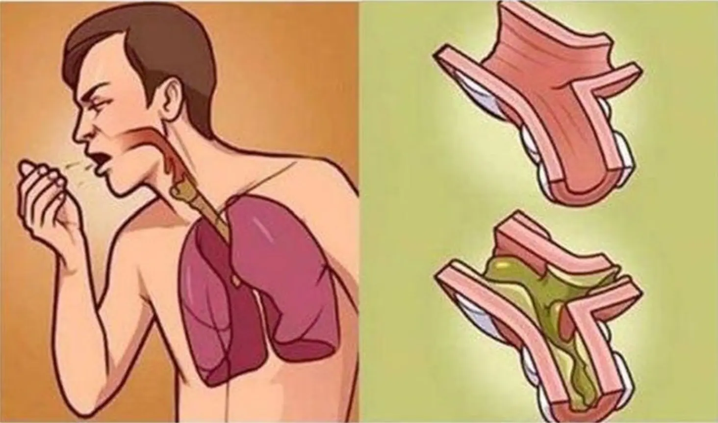 Why Is There Always Thick Mucus in Your Throat? The Overlooked Truth Behind Persistent Throat Irritation