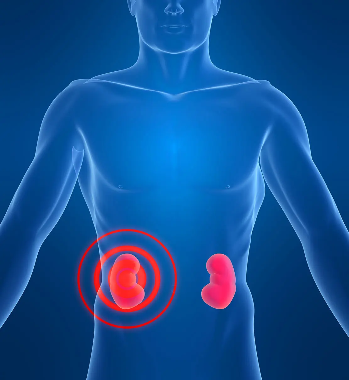 8 Early Warning Signs of Kidney Problems That Often Go Unnoticed