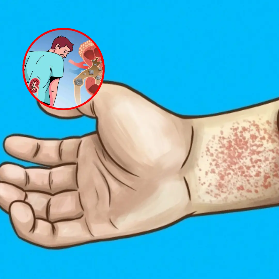 10 signs that you have kidney disease without knowing it