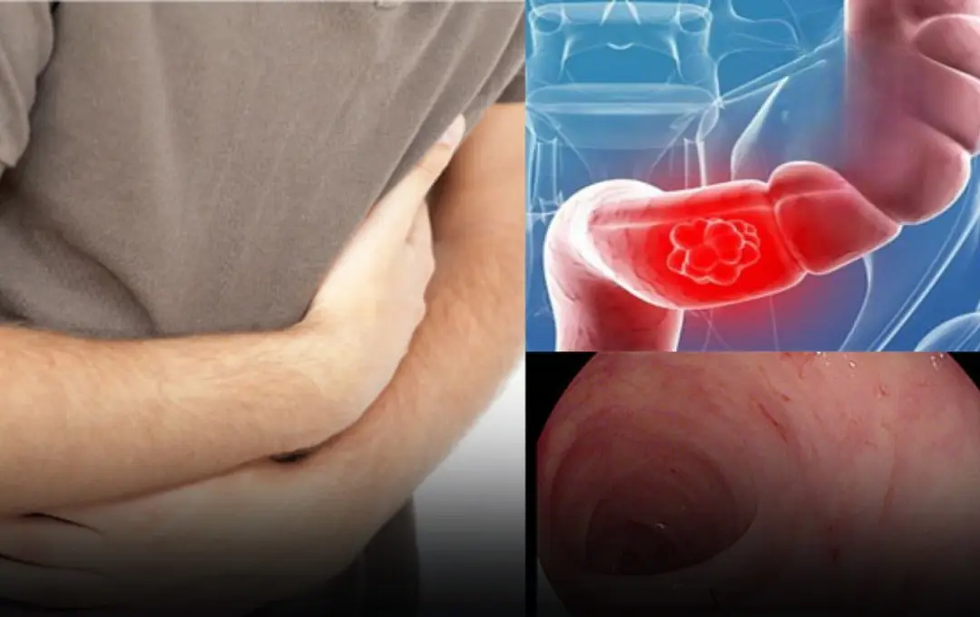 8 Warning Signs You Should Never Ignore When Using the Toilet