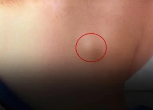 Those who have this sign should not ignore it