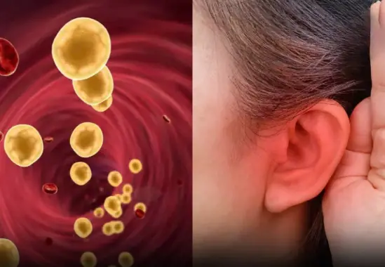 4 Subtle Clues on Your Body That Point to High Blo.o.d Fa.t