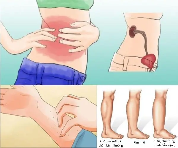 Kidney Health Alert: Key Warning Signs That Require Immediate Attention