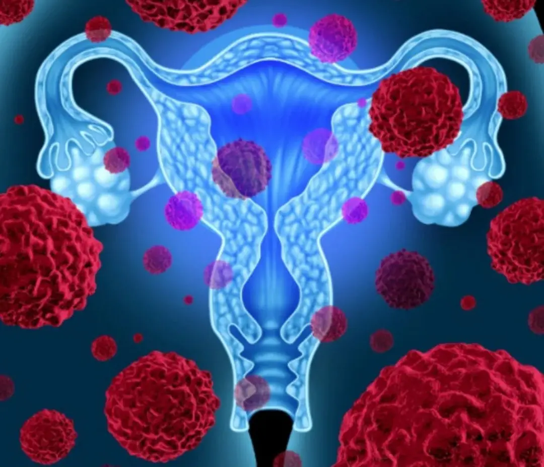 Some unhealthy habits during intimacy may be a hidden cause of cervical can.cer in women