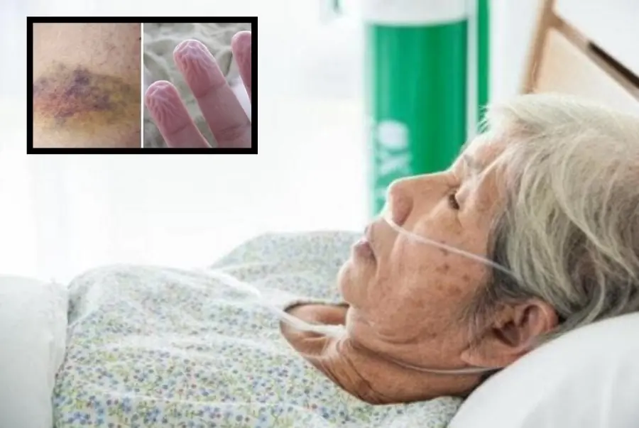 6 Warning Signs the Body May Show About a Year Before Death