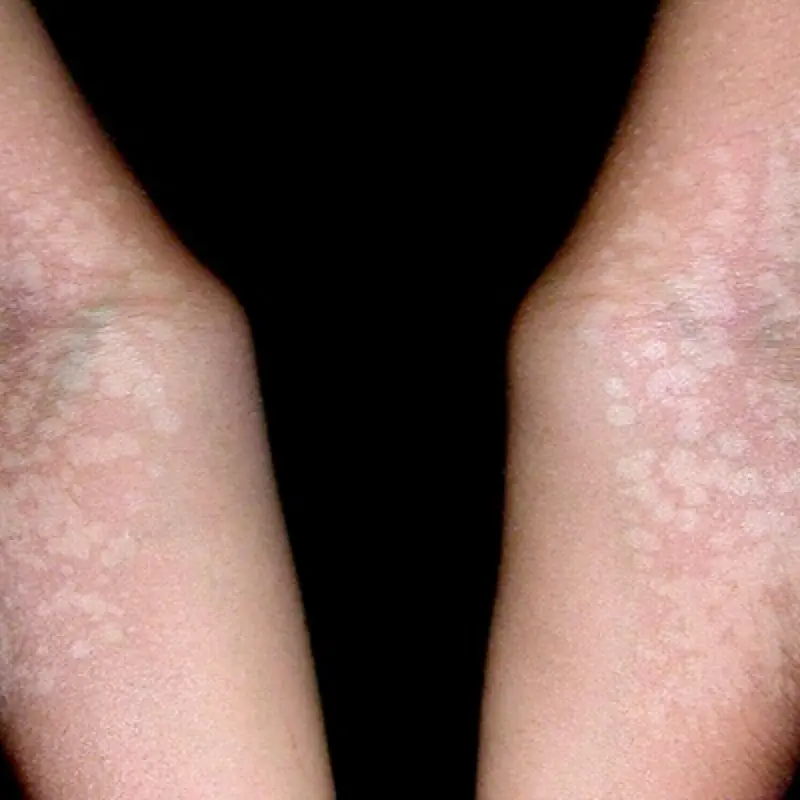 Have you ever spotted tiny white marks on your arms or legs and wondered what they mean?