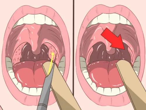 A Breakup Over Bad Breath Led to a Medical Shock: What Doctors Found Changed Everything