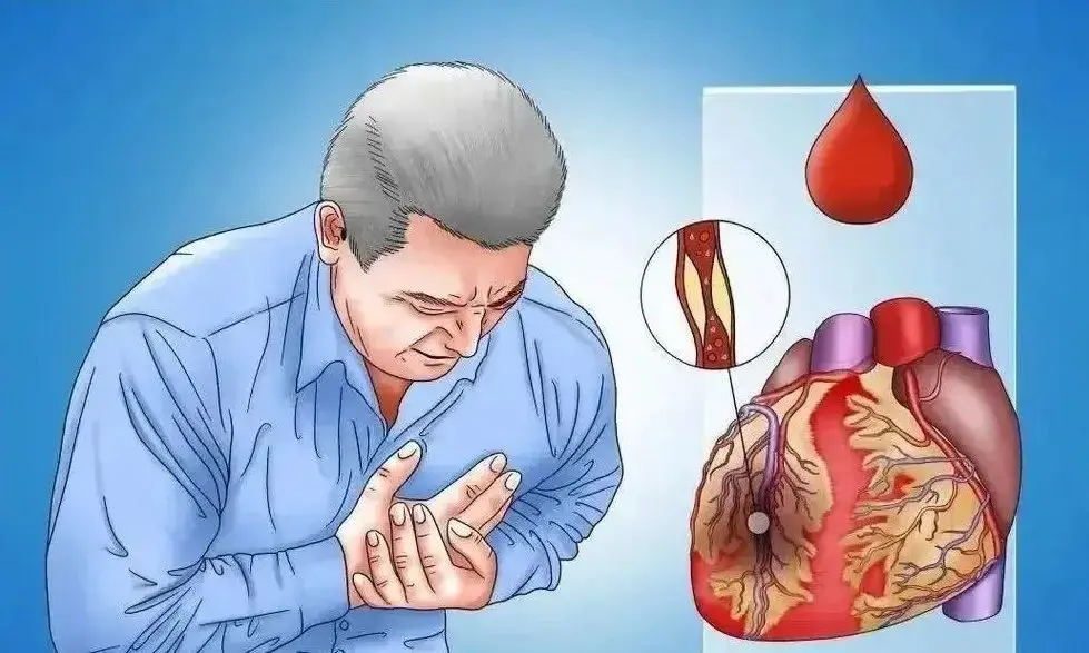 Many He.art Attacks Strike at These Moments: 10 Times When the Heart Is Most Likely to “Collapse” — Sadly, Many People Ignore Them