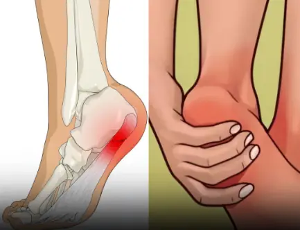 7 Powerful Exercises to Relieve Heel Pain and Treat Plantar Fasciitis Naturally