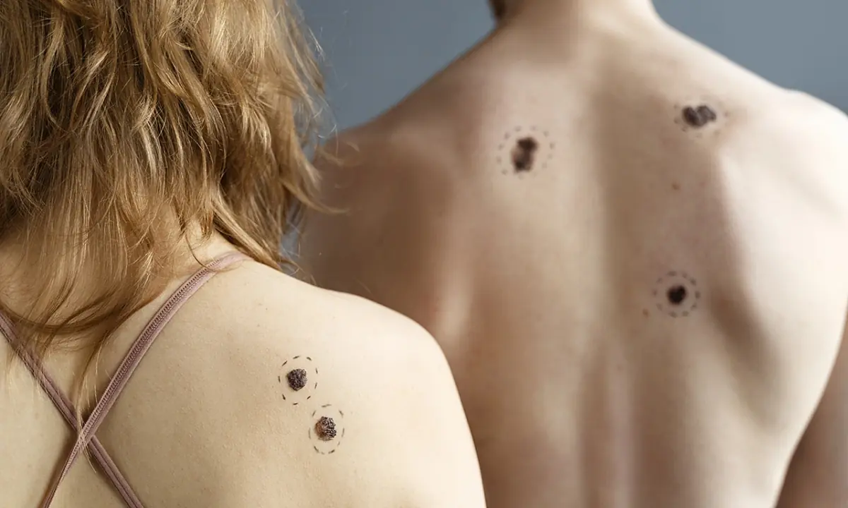 9 Early Signs of Diabetes You May Not Be Noticing