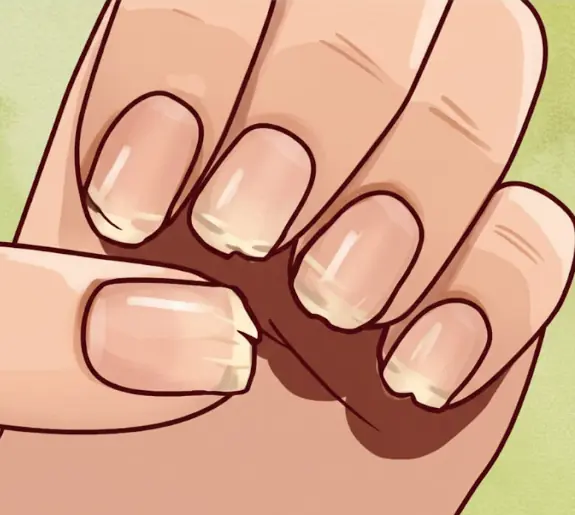 Doctors reveal 7 hidden health conditions your nails may be signaling
