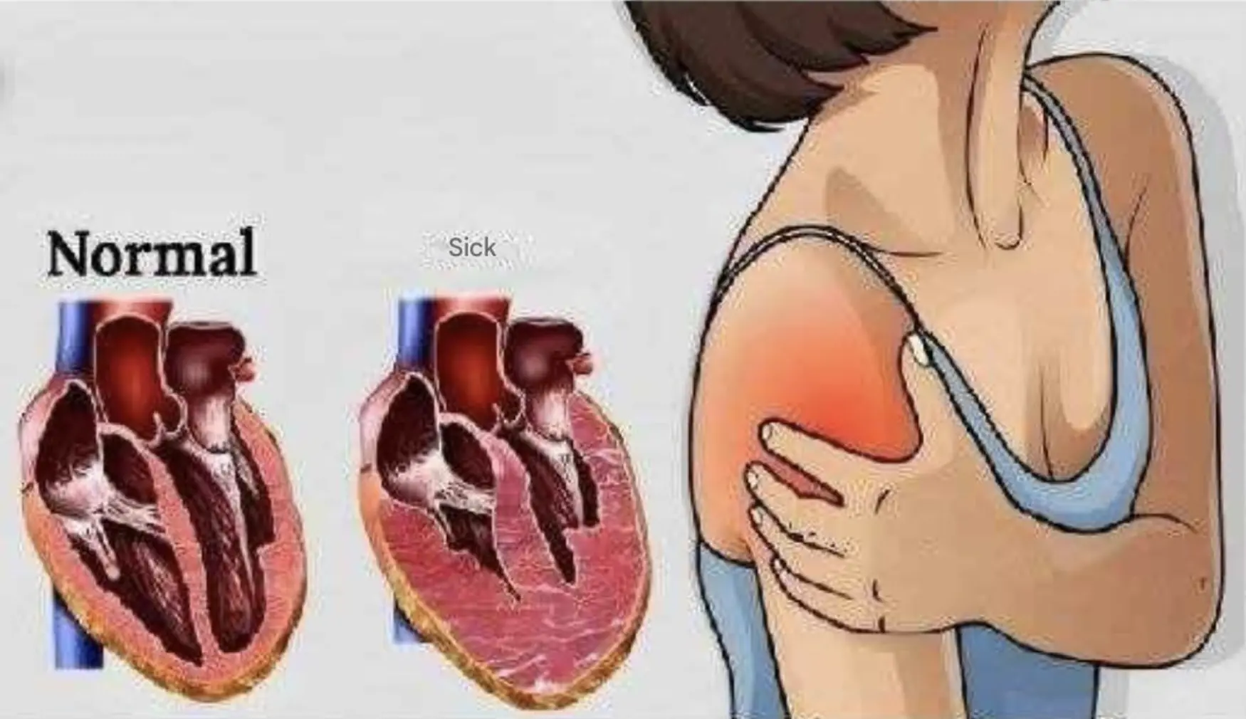 Dangerous He.art Symptoms Few People Recognize—and Why This Image Should Make You Pause