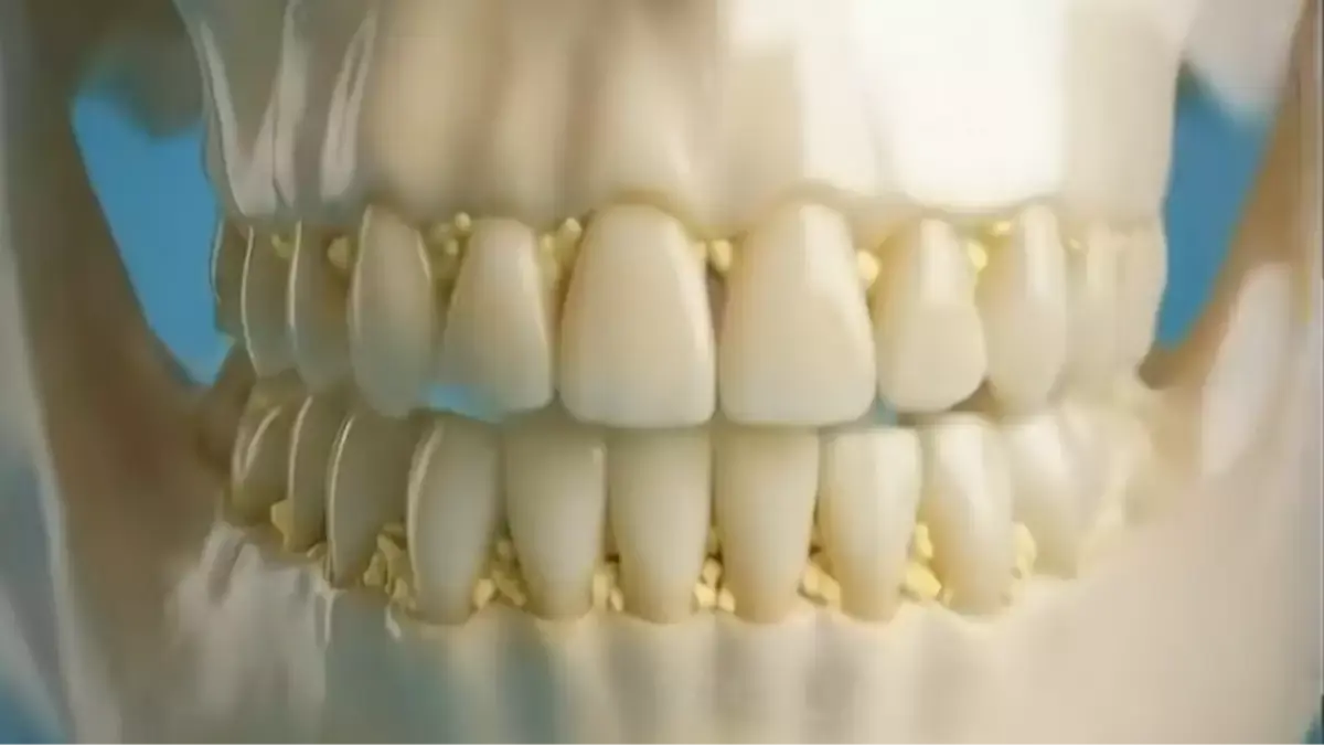 Horr:ifying simulation allegedly shows exactly what would happen to your teeth if you didn't brush them for 30 days