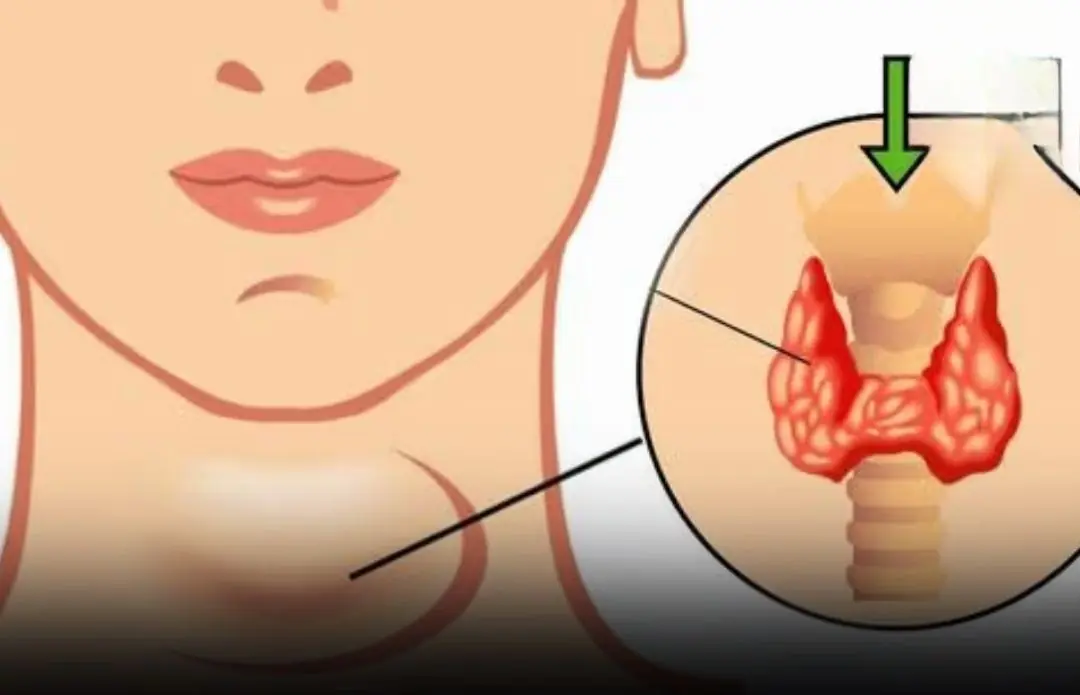 Thyroid Can.cer Warning: 7 Early Body Changes — The First 3 Are Surprisingly Common
