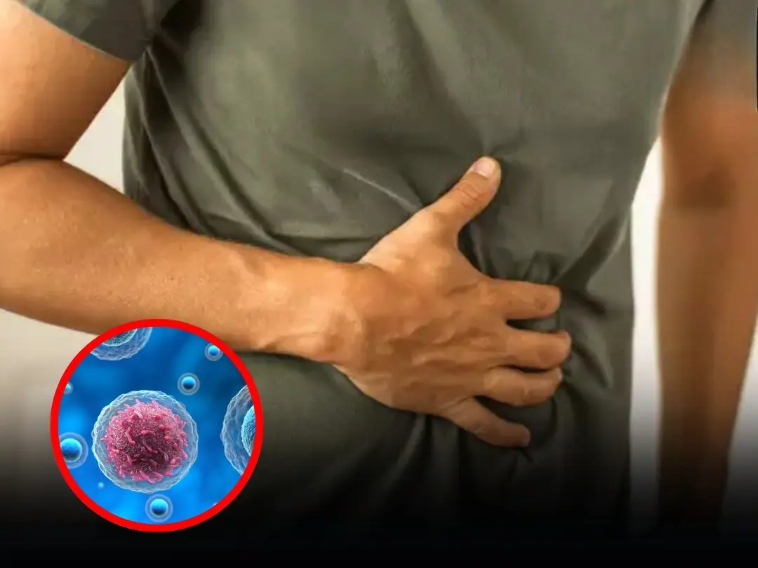 These 5 Easy-to-Miss Symptoms Could Be Signs of Can:cer, Experts Say