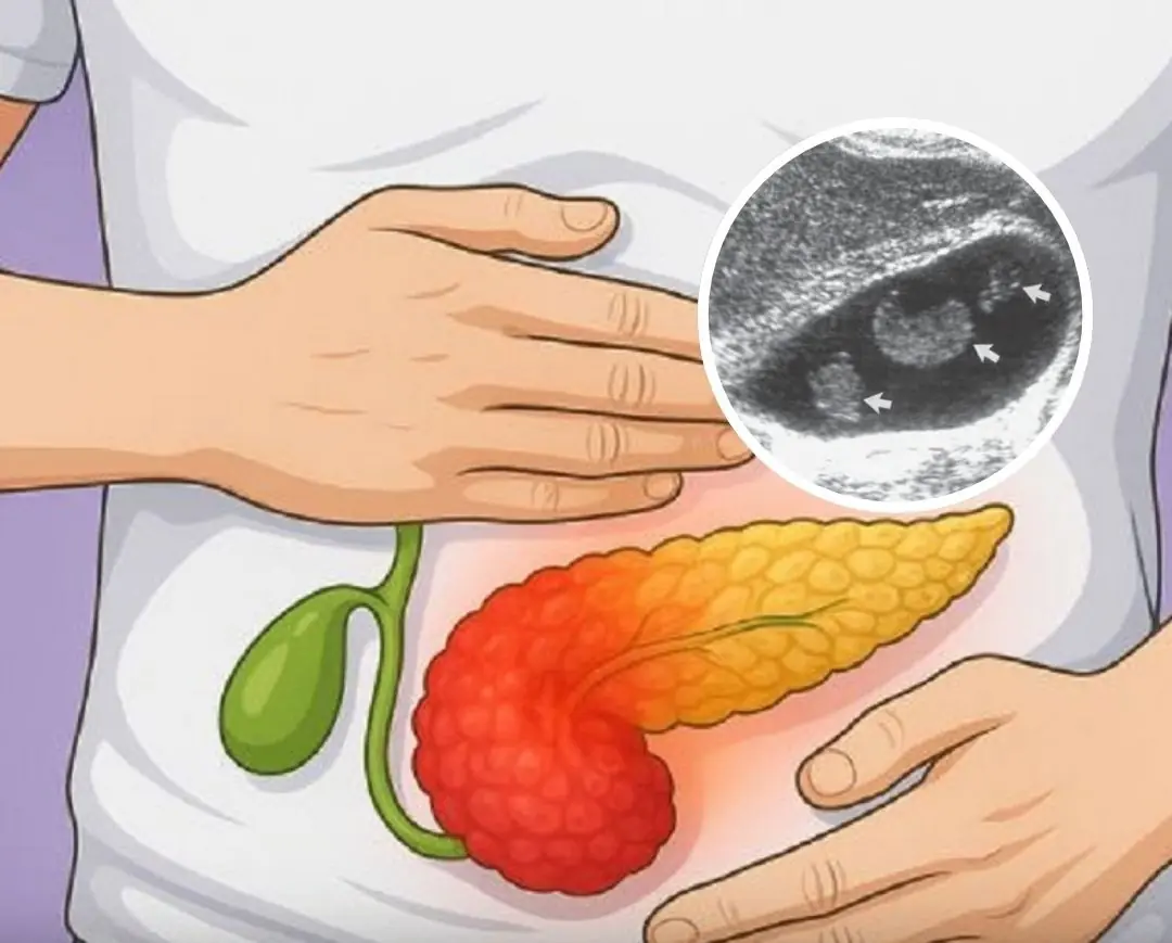 The Most Likely Symptoms of a Gallbladder Problem (Don’t Ignore Them)....