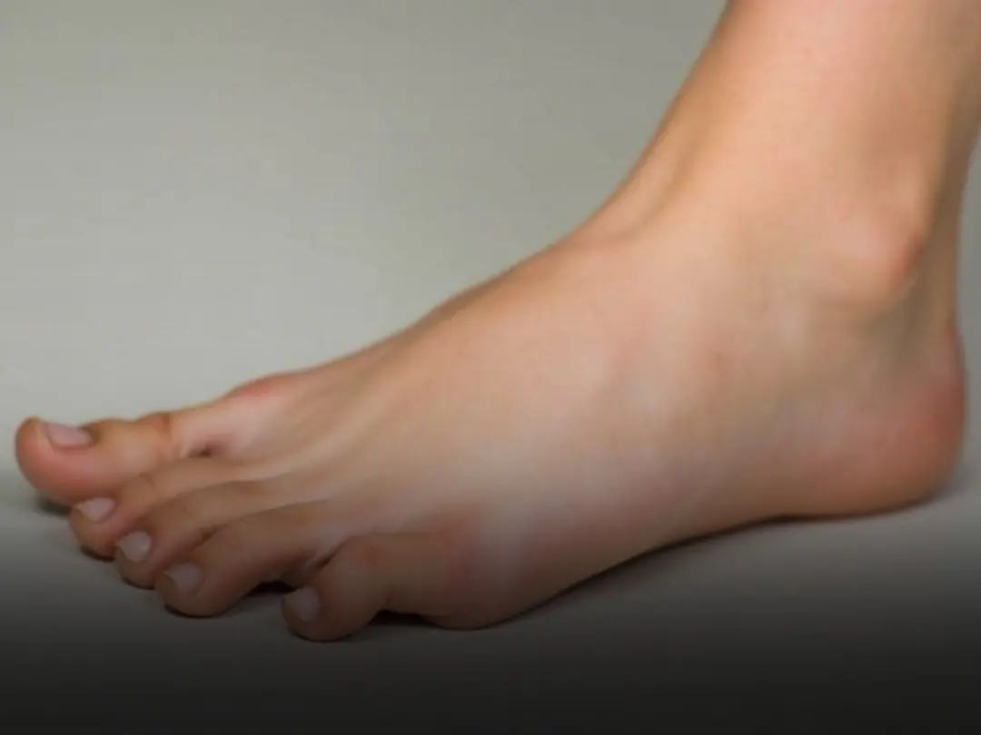 If You Notice This Change in Your Feet, Your Fat:ty Liver May Be Beyond Repair