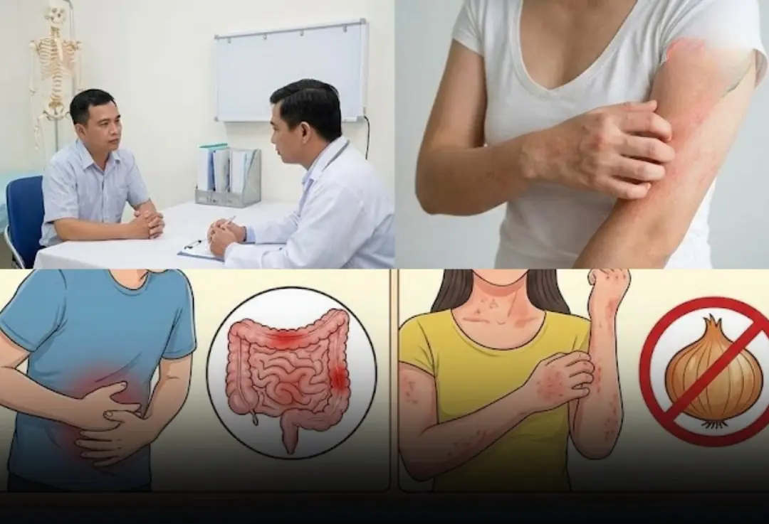 Not Everyone Should Eat Onions: Here’s Who Needs to Be Careful