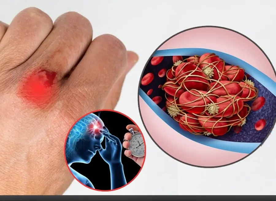 Stroke rarely comes without warning — these 9 silent brain clot signs can appear weeks earlier