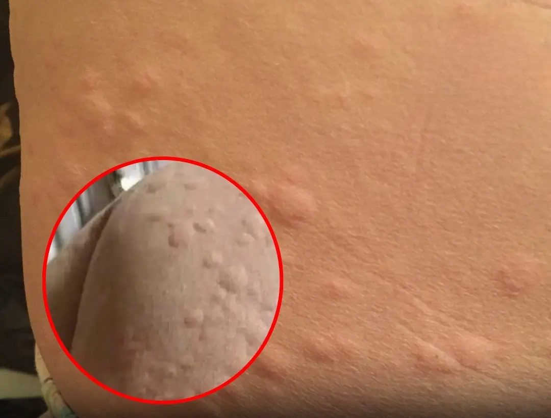 Don’t ignore it — itching and strange bumps on your skin could be a warning sign