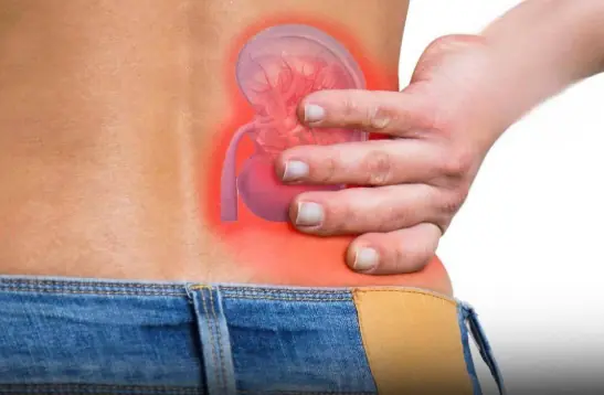 4 Healing Drinks to Prevent and Dissolve Kidney Stones