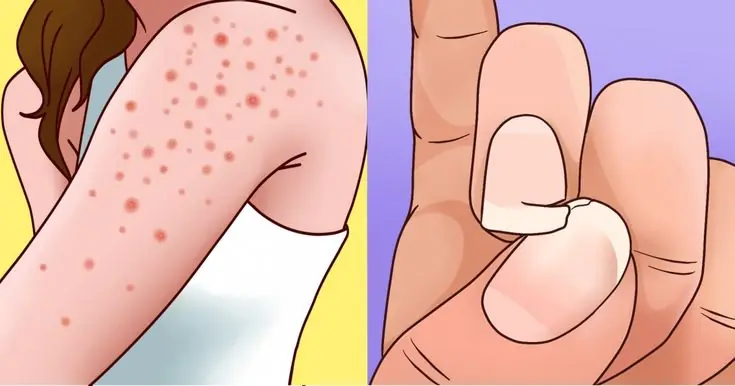 9 Warning Signs You May Be Gluten Sensitive (and Why It Matters)