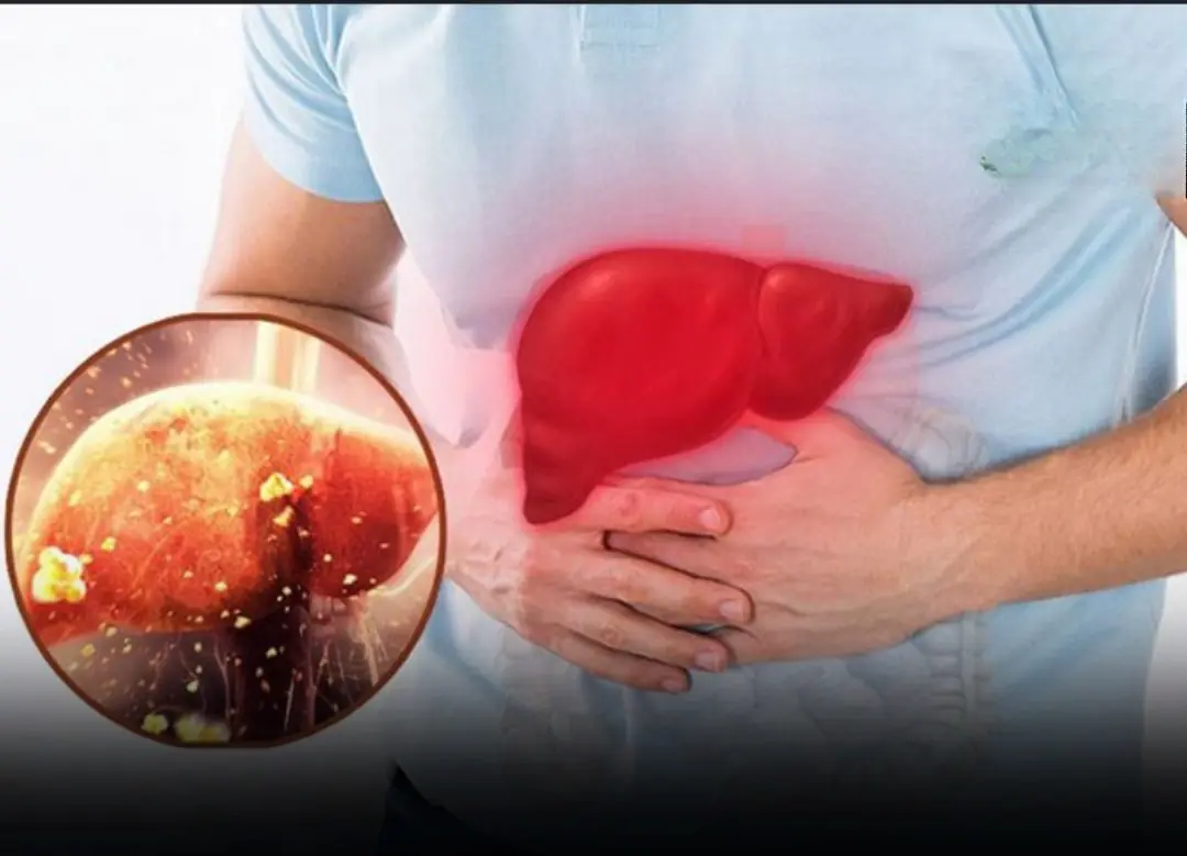 Fatty Liver Disease: The Foot Sign That Could Mean It’s Too Late to Reverse