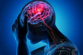 Warning signs you may have a brain hemorrhage, don't ignore them or you'll regret it too late