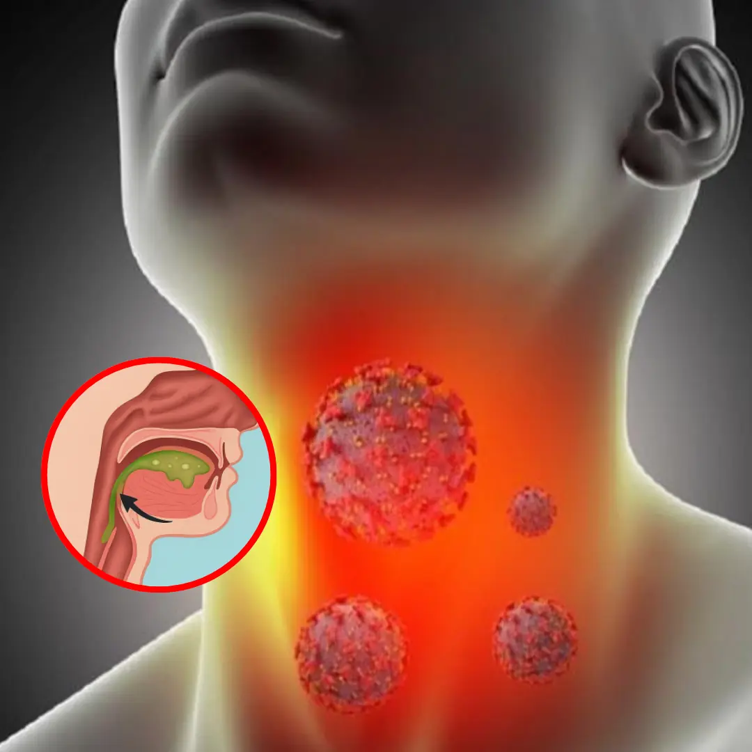 Why Your Throat Feels Mucusy: The Real Reasons Behind That Sticky Sensation