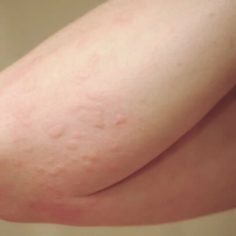 When Itchy Skin and Unusual Bumps Appear, Don’t Ignore the Warning Signs