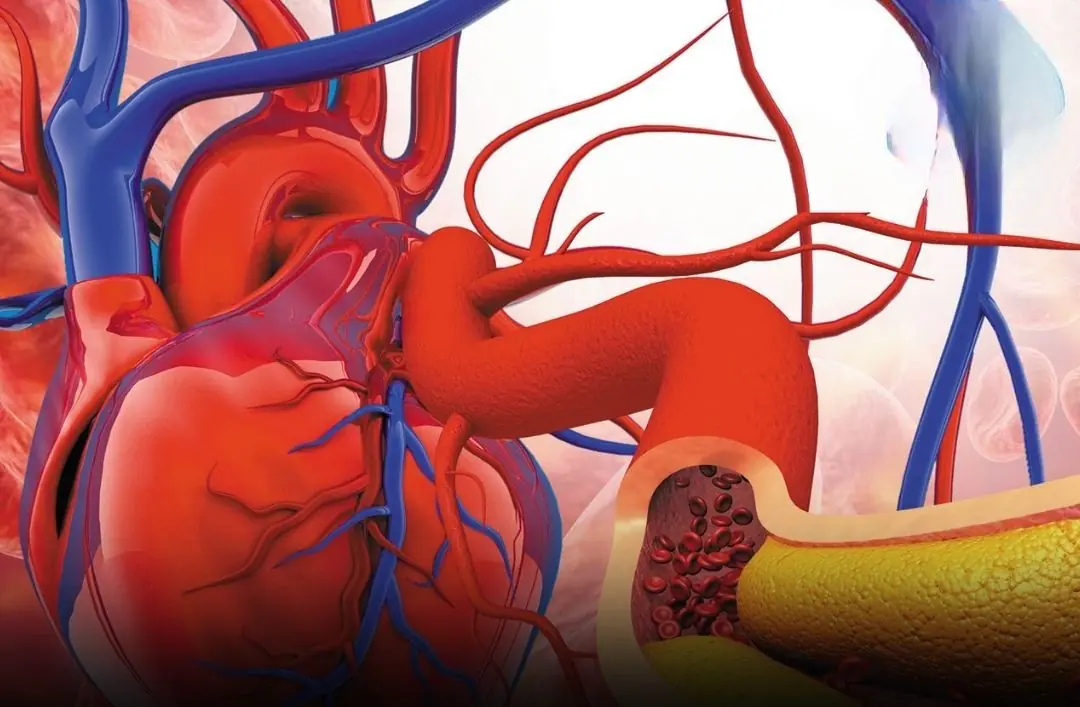 These 3 Morning Mistakes Make Blo:od Pressure & Cholesterol Worse