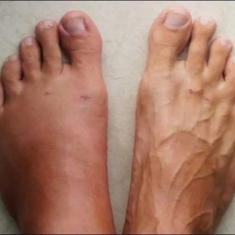 Your Body May Warn You Weeks Before a Heart Attack