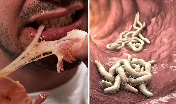 Doctor's War:ning: Stop Eating These 4 Foods Immediately They Contain Lots of Parasites