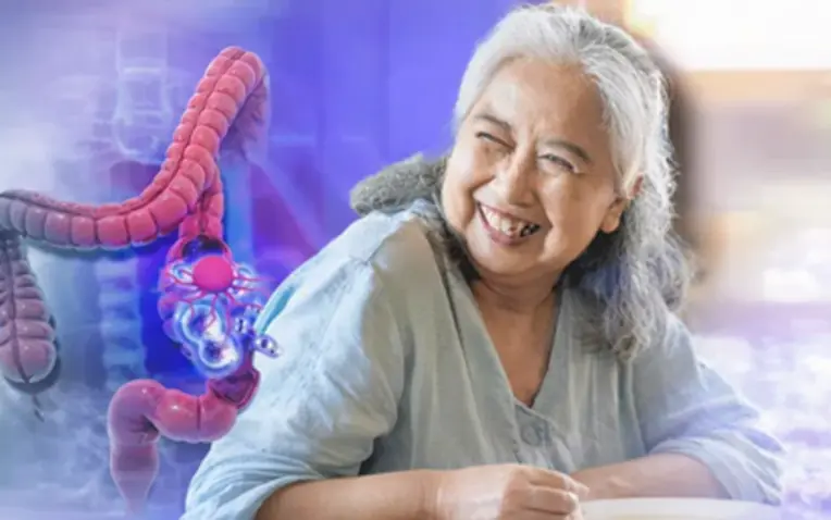 My mother-in-law developed rectal can.cer because of a seemingly harmless frugal habit, but 30 years later the disease has not recurred thanks to three important changes.